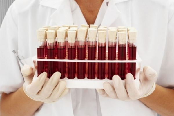 Японские ученые доказывают, что группа крови влияет на деловые и прочие характеристики человека